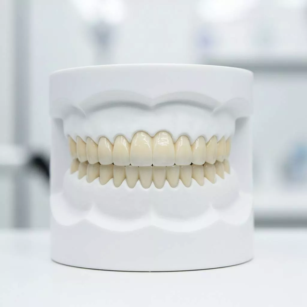 Zirconium Dental Veneers: Aesthetic Excellence and Enduring Solutions at Dentaverse Turkey, İzmir
